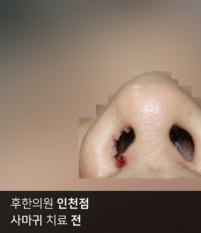 전후사진