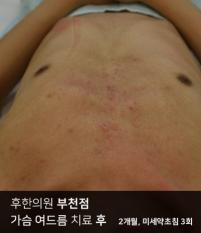 전후사진