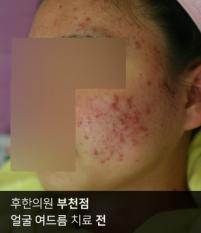 전후사진