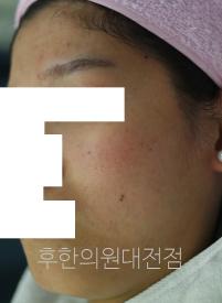 전후사진