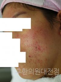 전후사진