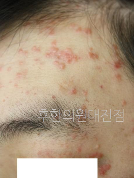 전후사진