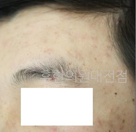 전후사진