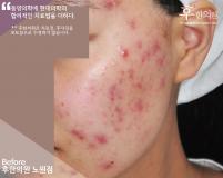 전후사진