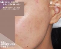 전후사진