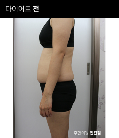 전후사진