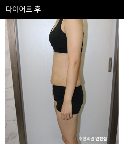 전후사진