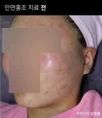 전후사진