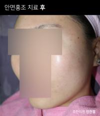 전후사진