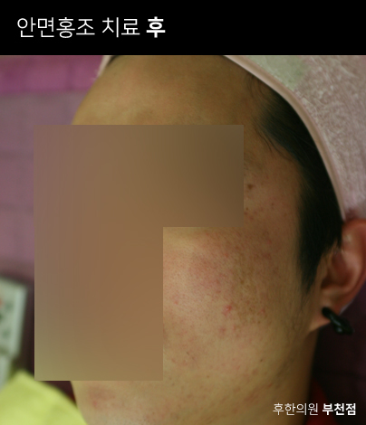 전후사진