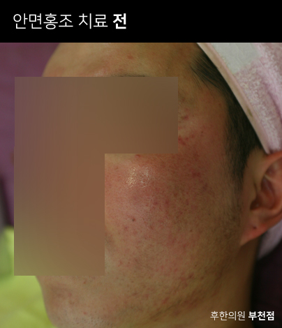 전후사진