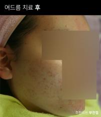 전후사진