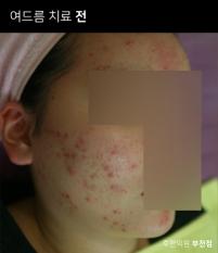 전후사진