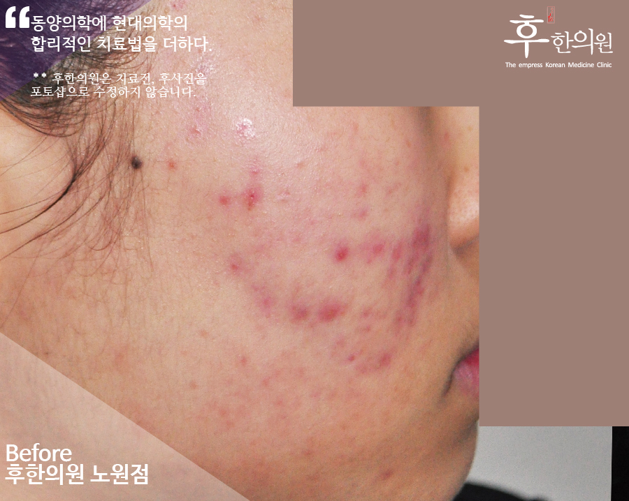 전후사진