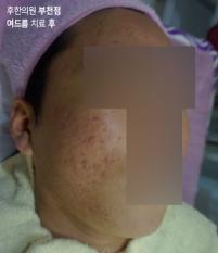 전후사진