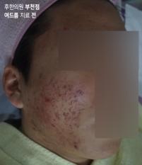전후사진