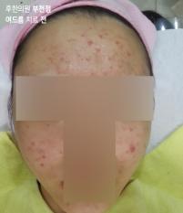 전후사진