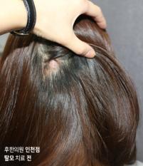 전후사진