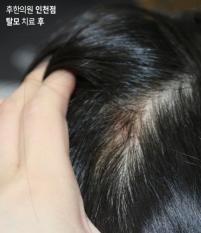 전후사진
