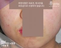전후사진