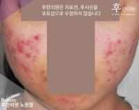 전후사진