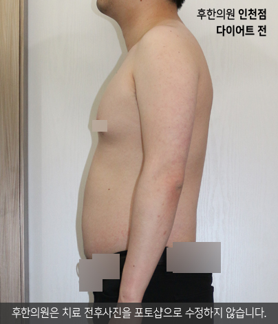 전후사진