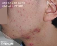 전후사진
