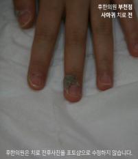 전후사진