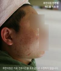 전후사진