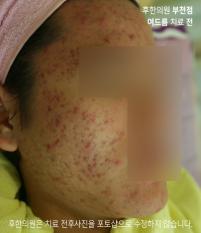 전후사진