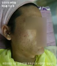전후사진