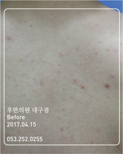 전후사진