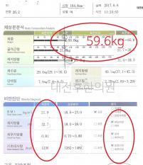 전후사진