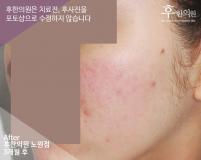 전후사진