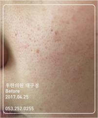 전후사진