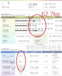 전후사진