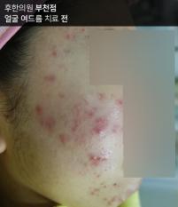 전후사진