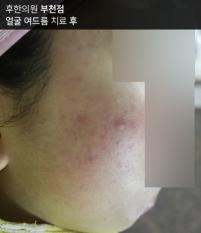 전후사진
