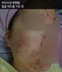 전후사진