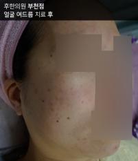 전후사진