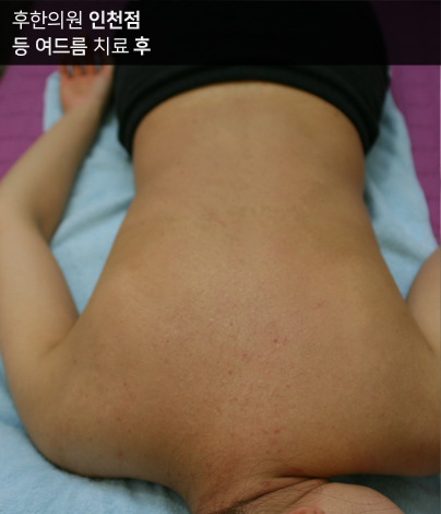 전후사진