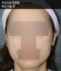 전후사진