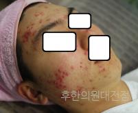 전후사진