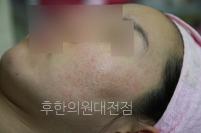 전후사진
