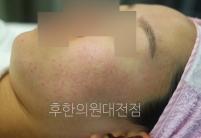 전후사진