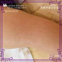 전후사진