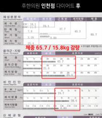 전후사진