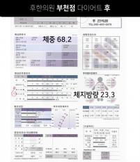 전후사진