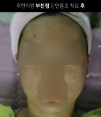 전후사진