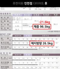 전후사진